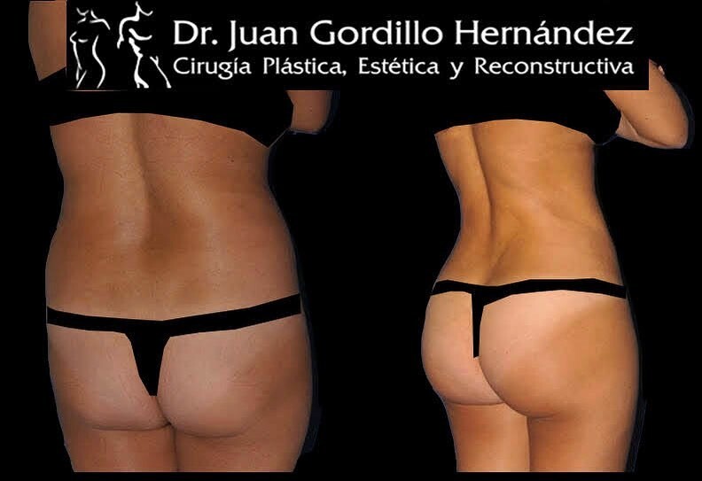 Clinic Results Gallery